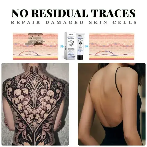 Tattoo Removal Cream - Fast Painless & Scar-Free Tattoo Erasure - Image 7