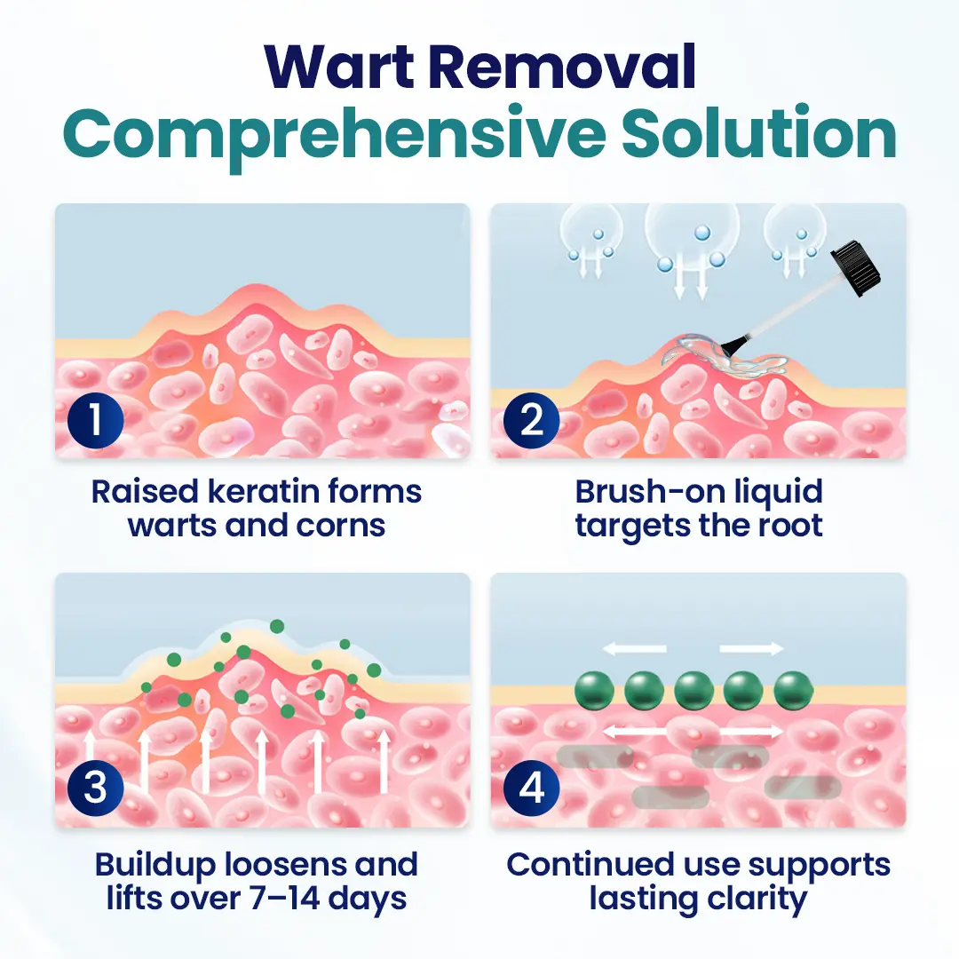 WartLift Corn Removal Liquid - Image 6