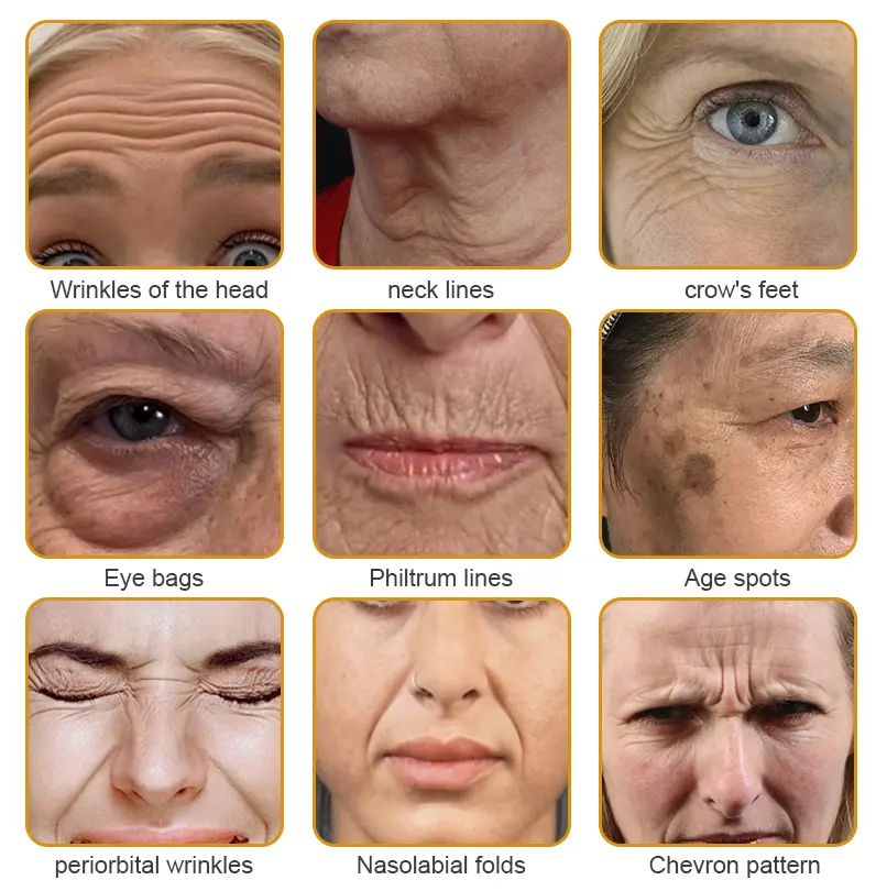 Winter Sale Botox Bee Venom Wrinkle Removal Cream - Image 3