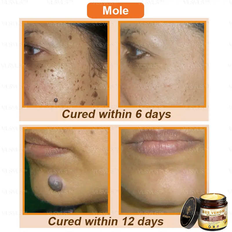 Winter Sale Bee Venom Skin Restoration Cream - Image 5