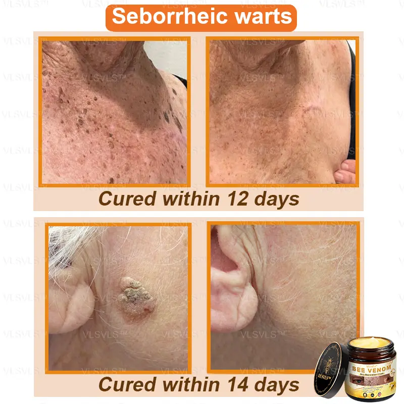 Winter Sale Bee Venom Skin Restoration Cream - Image 6