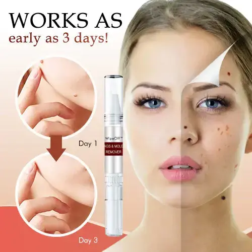 Tags & Moles Remover - Image 4