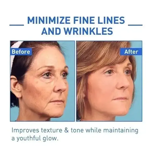 BotoxMAX Face Serum - Image 3