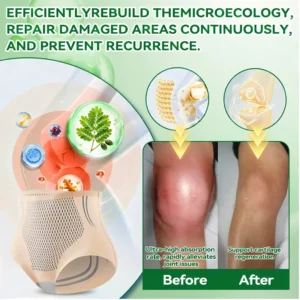 𝐄𝐗𝐏𝐄𝐂𝐓𝐒𝐊𝐘® 𝟏𝟎-𝐈𝐍-𝟏 𝐌𝐨𝐫𝐢𝐧𝐠𝐚 * 𝐁𝐞𝐫𝐛𝐞𝐫𝐢𝐧𝐞 * 𝐍𝐀𝐃+ 𝐀𝐝𝐯𝐚𝐧𝐜𝐞𝐝 𝐌𝐚𝐠𝐧𝐞𝐭𝐢𝐜 𝐭𝐡𝐞𝐫𝐚𝐩𝐲 𝐬𝐥𝐢𝐦𝐦𝐢𝐧𝐠 𝐁𝐫𝐢𝐞𝐟𝐬