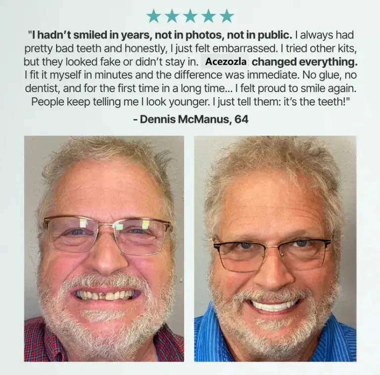 Custom-Fit Fully Functional Dentures - Image 11