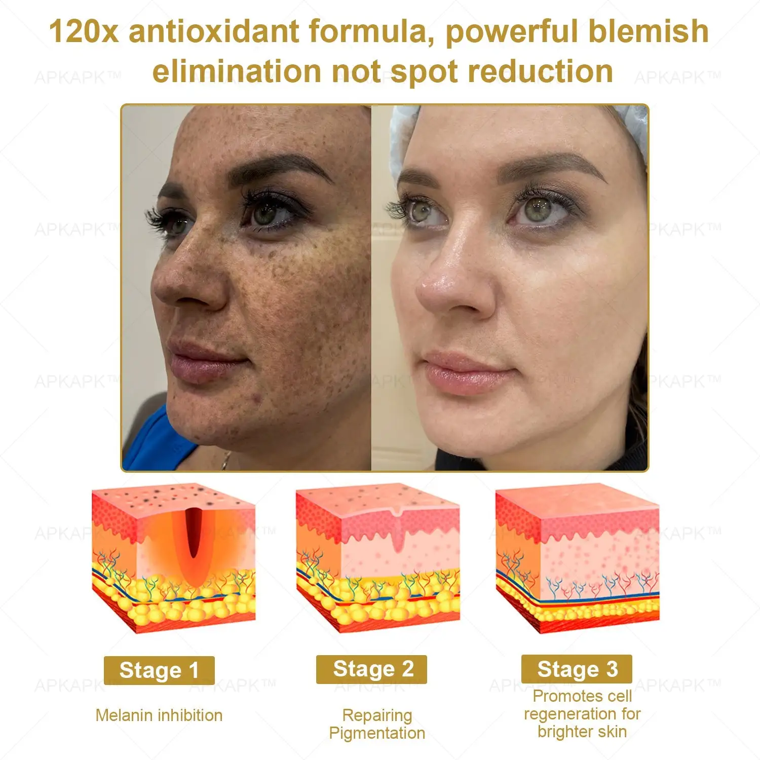 Effective All-in-One Skin Treatment Cream - Image 3