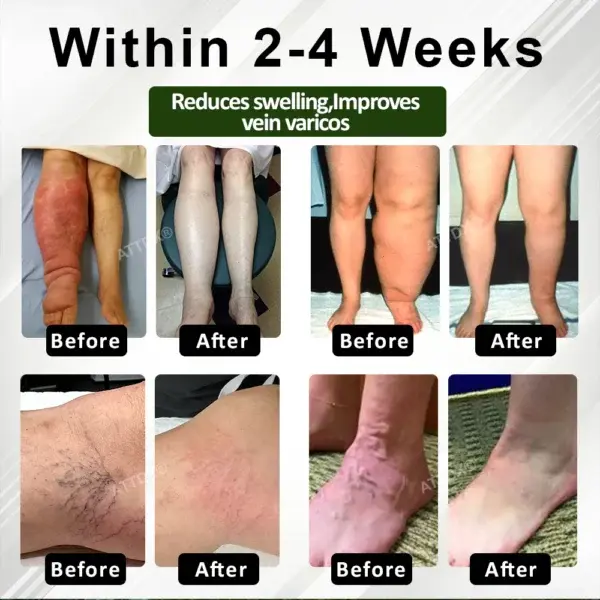 CircuHerb Edema Soothing & Healing Balm - Image 13