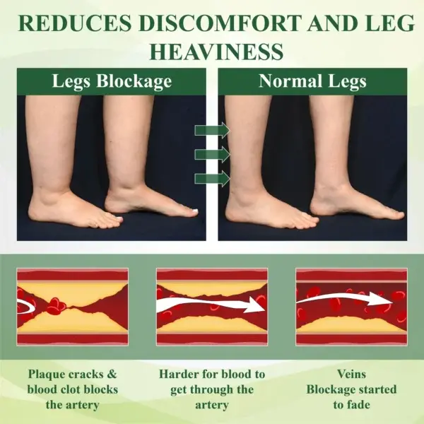 CircuHerb Edema Soothing & Healing Balm - Image 6