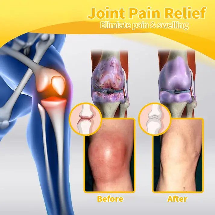Bee Venom Advanced Joint and Bone Therapy Cream - Image 9