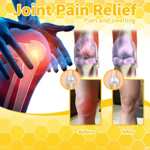 Bee Venom & Turmeric Arthritis Therapy Cream - Image 15