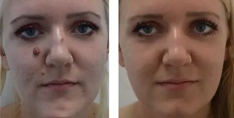 Bee Venom Skin Treatment Cream - Image 2