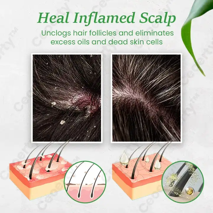 ReGenix Hair Growth Serum - Image 7