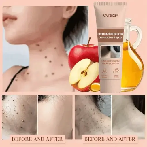 Purifying Exfoliating Gel - Image 4