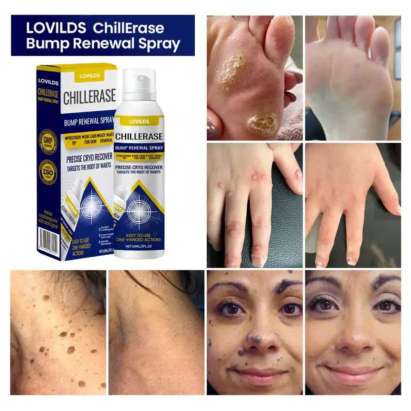 ChillErase Bump Renewal Spray - Image 2