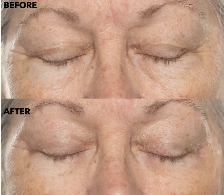 Double Retinol & Collagen Peptide Serum Treatment - Image 4