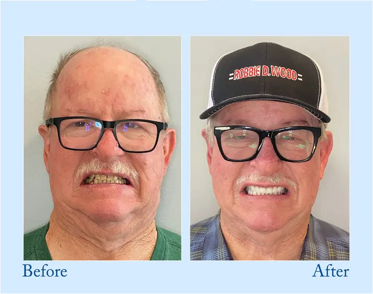 Fluoride-Free Hydroxyapatite Toothpaste - Image 7