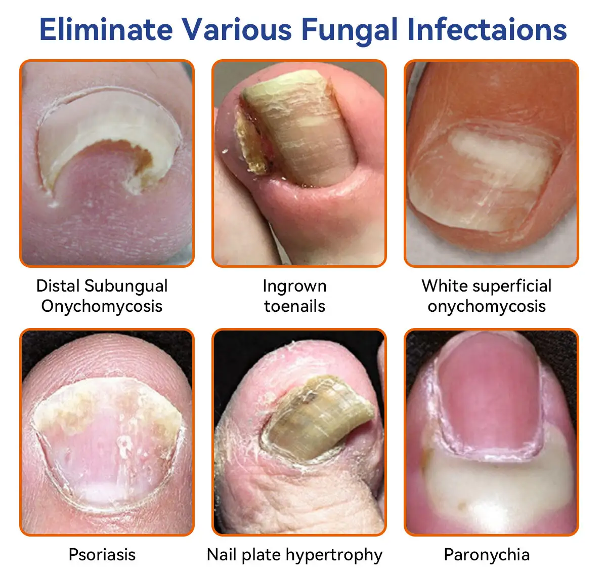 Bee Venom Nail Fungus Treatment Cream - Image 2