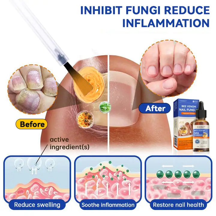 Bee Venom Nail Fungus Treatment Cream - Image 5