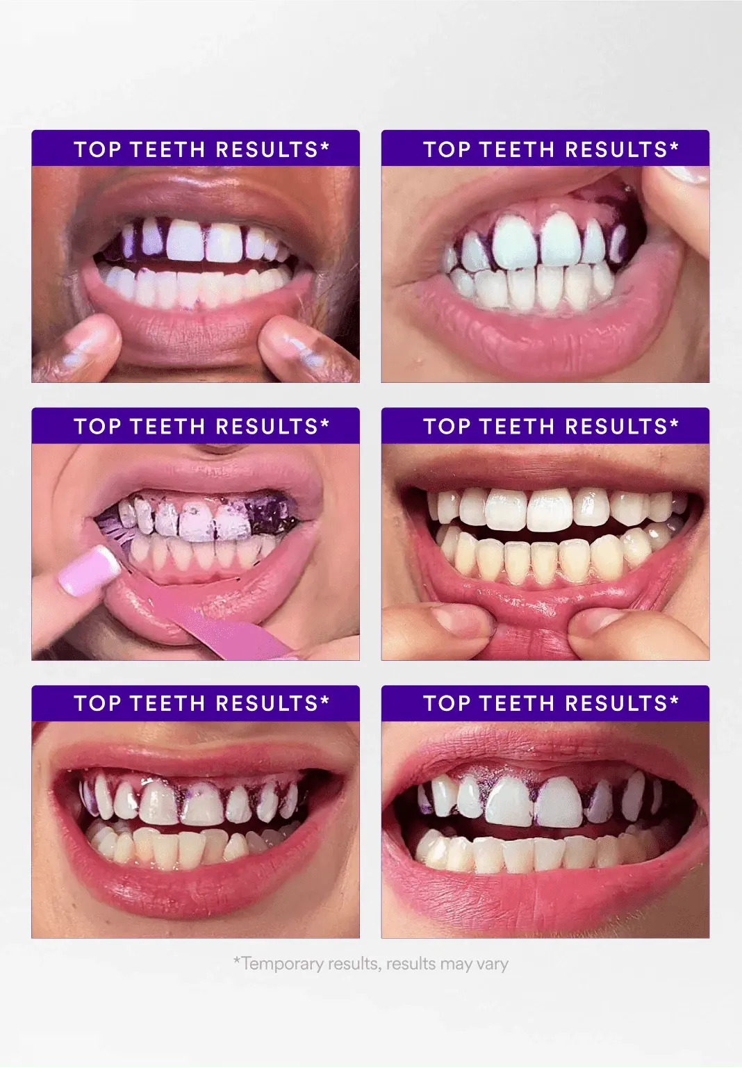 Purple Teeth Whitening Strips - Image 8