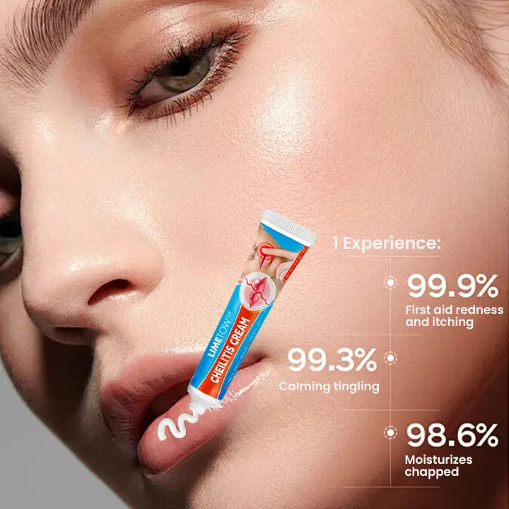 Cheilitis Cream - Image 9