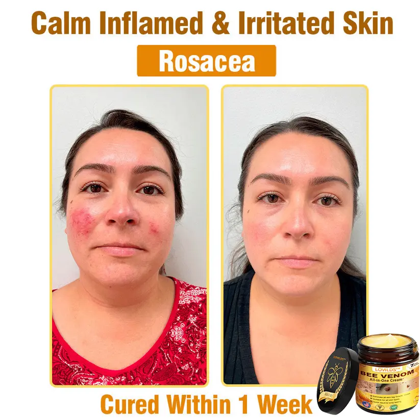 Bee Venom All-in-One Cream - Image 7