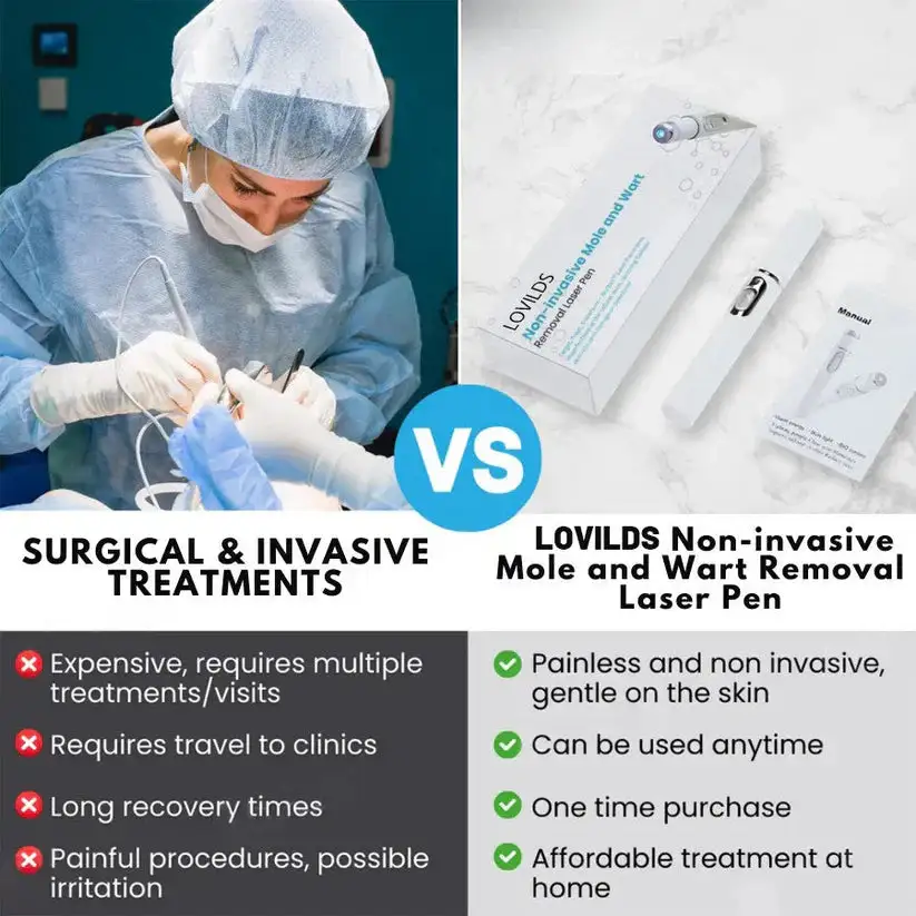 Non-Invasive Mole and Wart Removal Laser Pen - Image 10