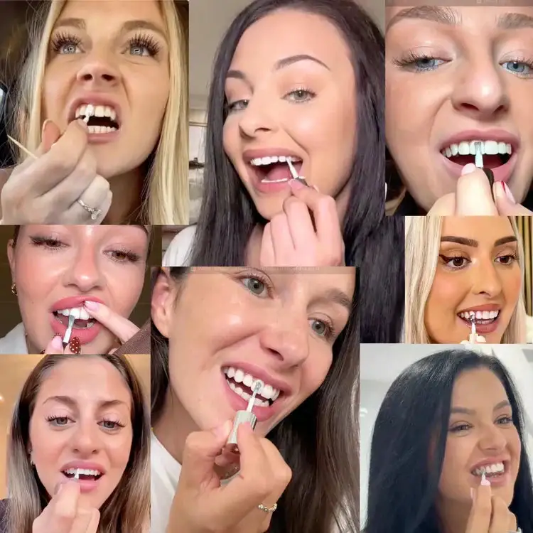 Tooth Polish - Instant Whitening for a Sparkling Smile - Image 4
