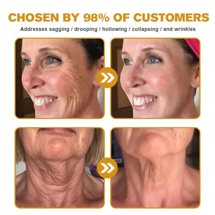 Bee Venom Skin Restoration Cream - Image 12