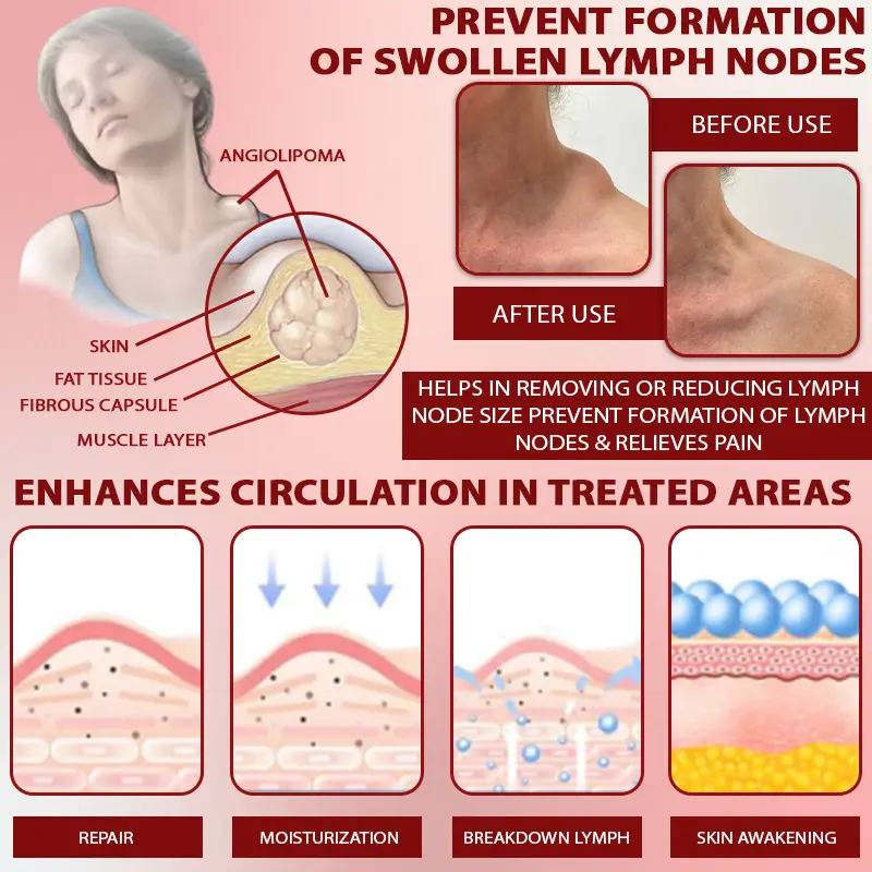 Horse Chestnut SwellAway Massage Gel - Image 7