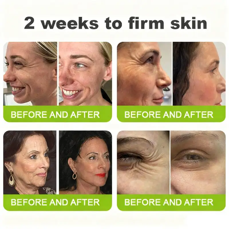 👏🌿 Made in the USA direct shipping Botox Vitamin A Retinol Anti-Wrinkle Firming and Lifting Cream - Image 3