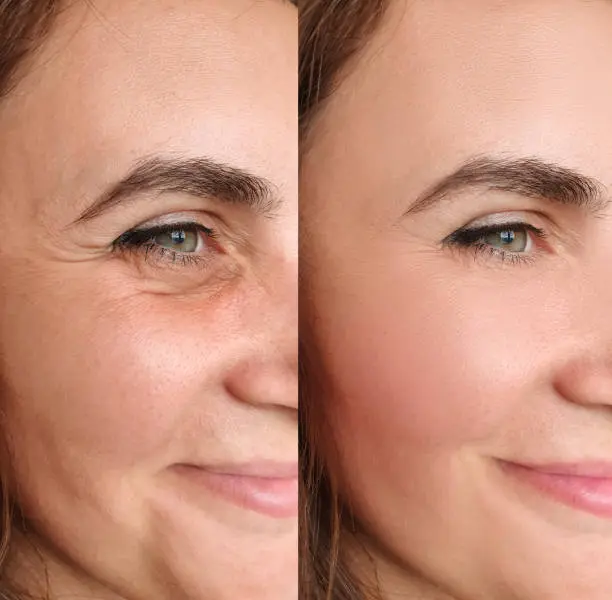 The Natravor Hyaluronic Acid 2% + B5 - Image 6