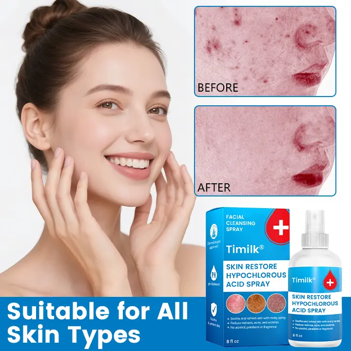 Skin Restore Hypochlorous Acid Spray - Image 5