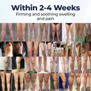 Alternative view of SwellRelief Circulation Support Cream