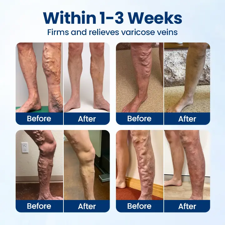VenoRelief Botanical Leg Spray - Image 2