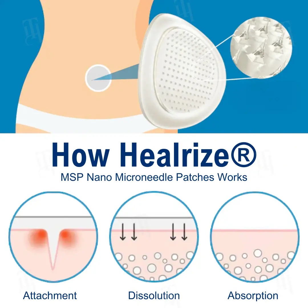 Nano Microneedle Patches - Image 4