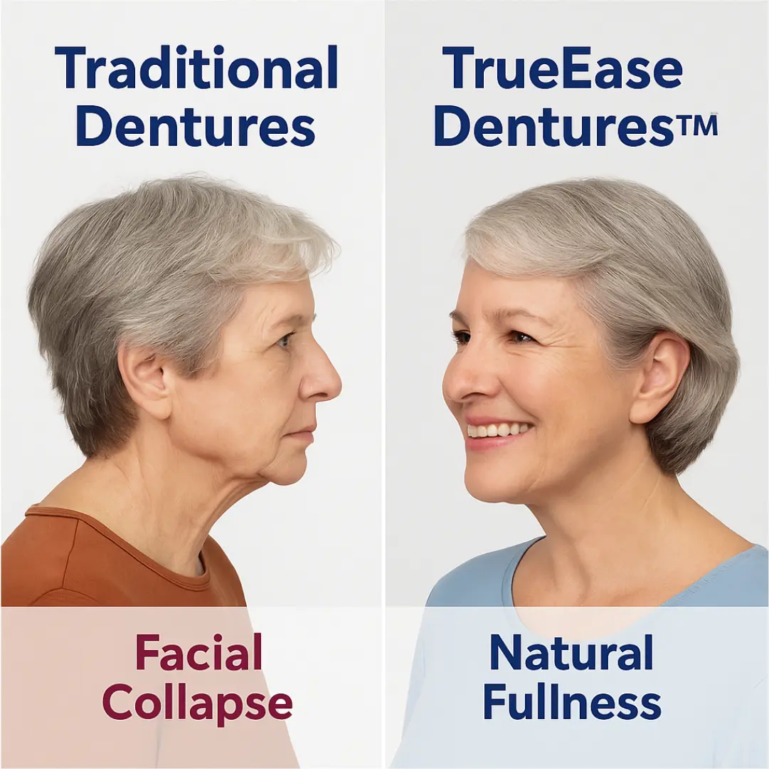 Custom-Fit Functional Dentures – Full Set - Image 3