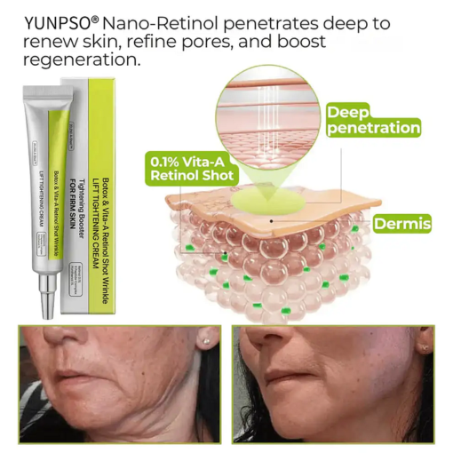 Botox & Vita-A Retinol Shot Wrinkle-Lift Tightening cream