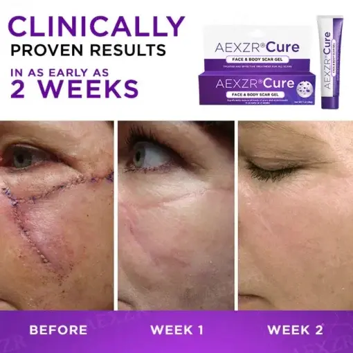 Cure Face & Body Scar Gel - Image 3