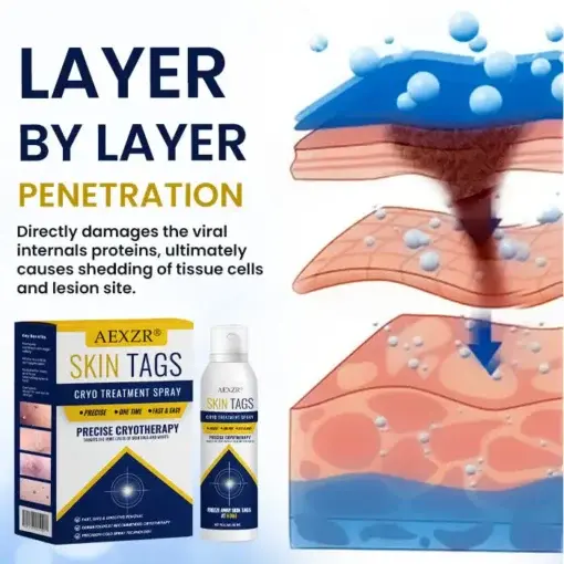 Skin Tag Cryo Treatment Spray Precision Cryo-Tech Freezes Away Skin Tags Warts in Seconds No Blades, No Pain - Image 4