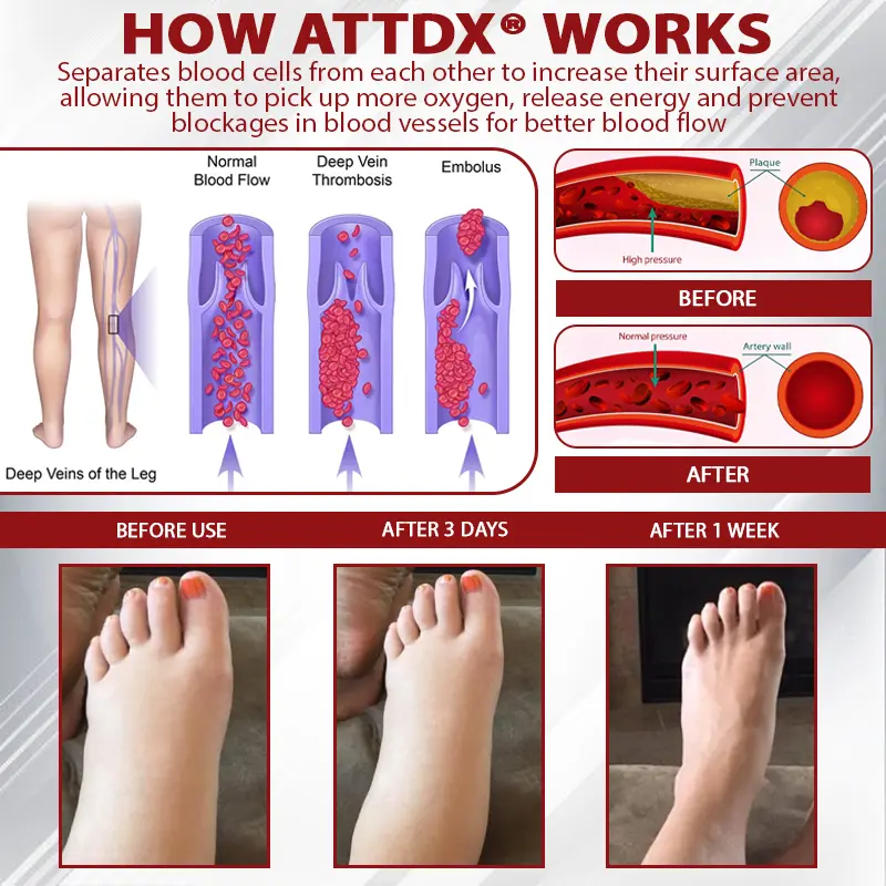 Advanced CVI Edema Therapy Cream - Image 5
