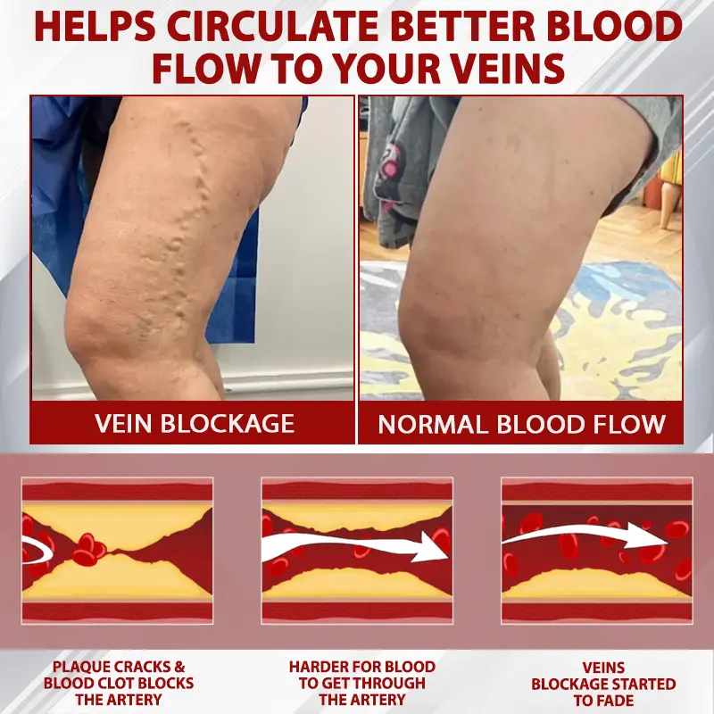 Advanced CVI Edema Therapy Cream - Image 6