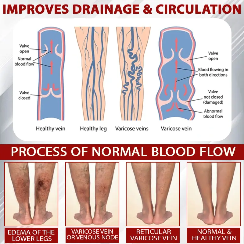 Advanced CVI Edema Therapy Cream - Image 7