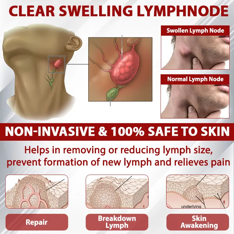 Advanced CVI Edema Therapy Cream - Image 8