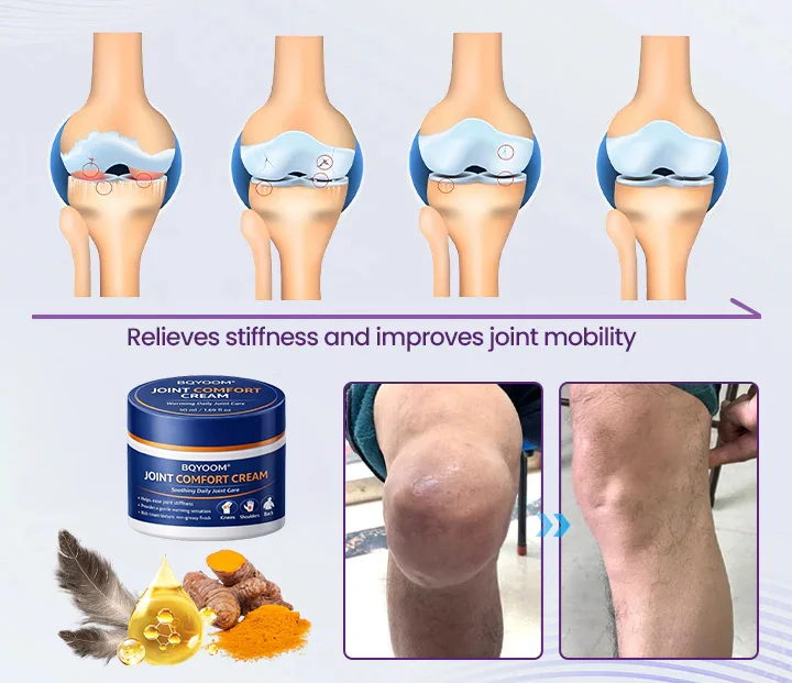 Joint Relief Gel – Natural Herbal Ointment Wellness - Image 2