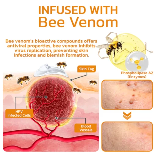 Bee Venom Mole and Wart Treatment Cream - Image 3