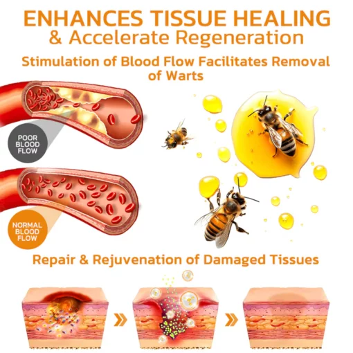 Bee Venom Mole and Wart Treatment Cream - Image 6