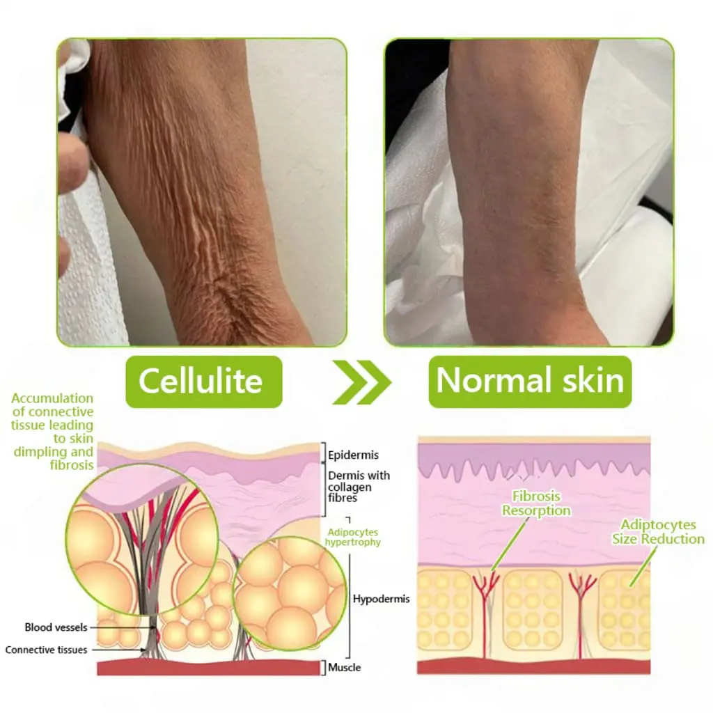 Botox & Retinol Shot - Eraser for deep wrinkles - Image 12