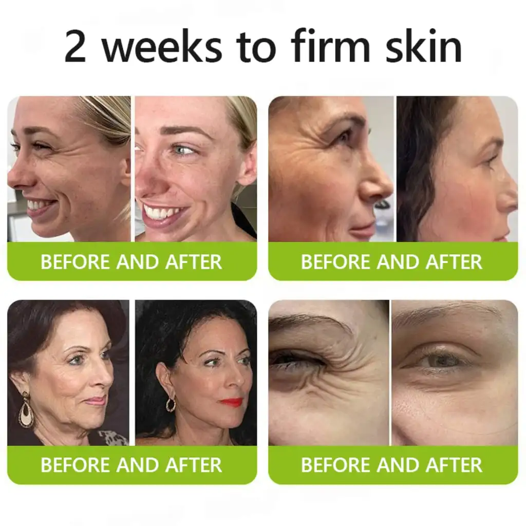 Botox & Retinol Shot - Eraser for deep wrinkles - Image 17