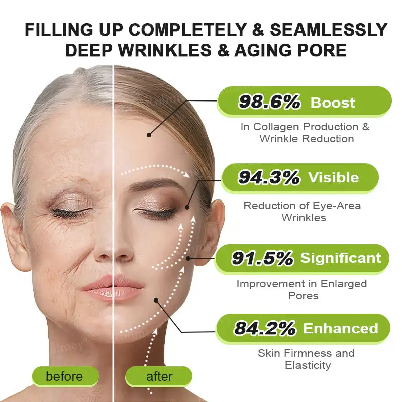 Botox & Vita A Retinol Shot Wrinkle Lift Tightening Cream - Image 6