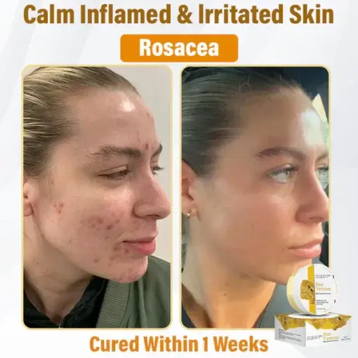 Bee Venom Skin Renewal Cream - Image 7